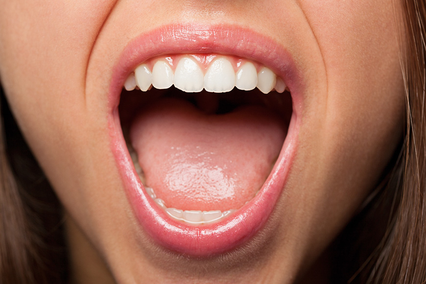 A young pretty woman teeth extreme closeup photo